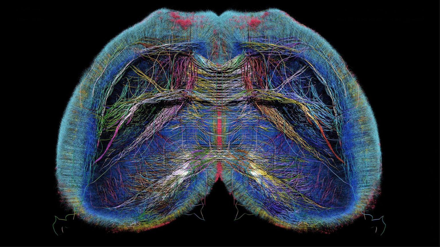 Neuro‑X